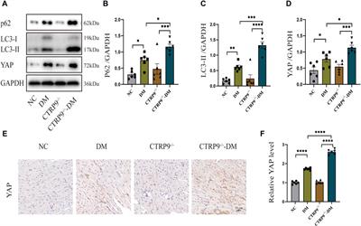 Knockout of C1q/tumor necrosis factor-related protein-9 aggravates cardiac fibrosis in diabetic mice by regulating YAP-mediated autophagy